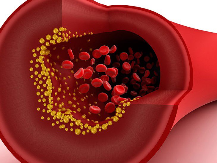 Tác dụng của quả óc chó với sức khỏe Quả óc chó giúp làm giảm cholesterol trong máu